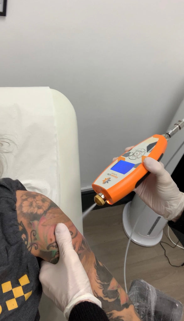 Cryo Therapy Now Available!