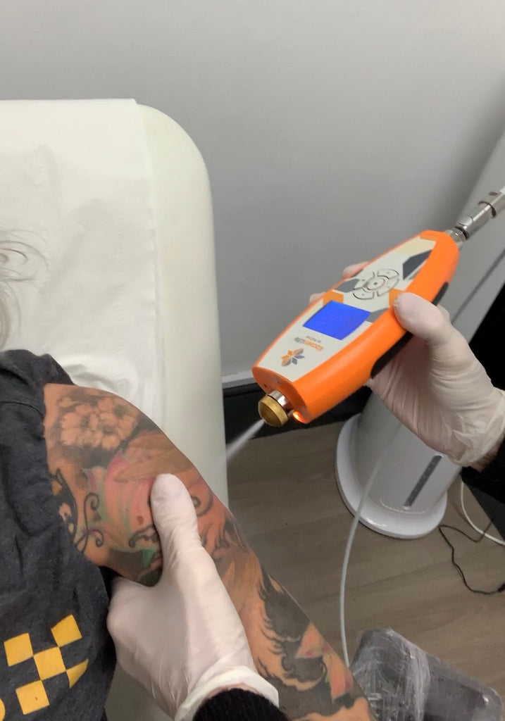 Cryotherapy